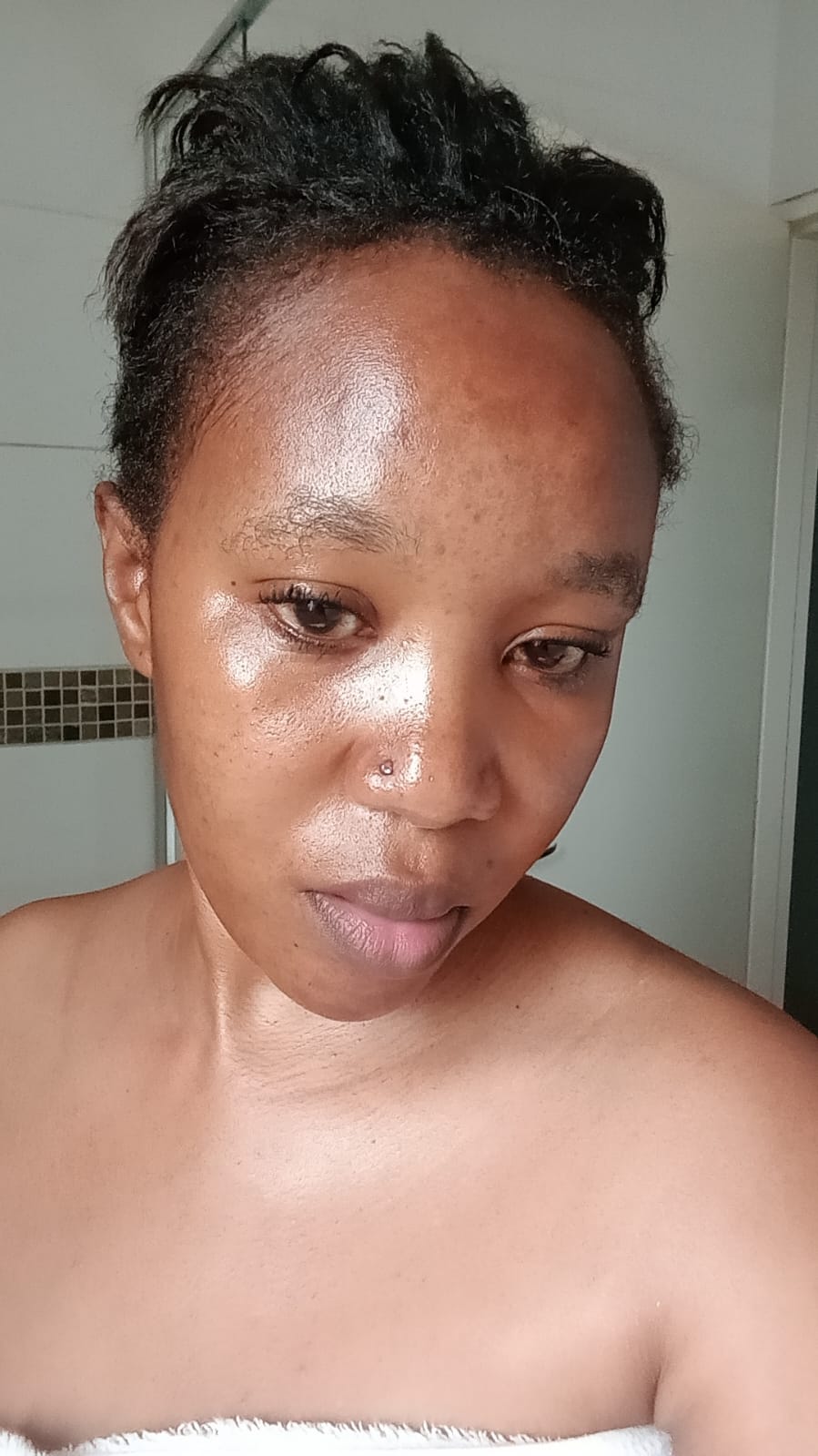 After — Even skin tone restored